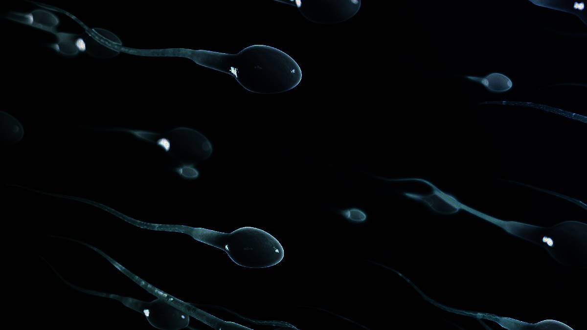 Rüyada Sperm Görmek