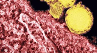 mers-virüsü-nedir-mers-virüsü-belirtileri